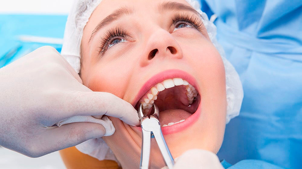 Udalenie-molochnyh-zubov